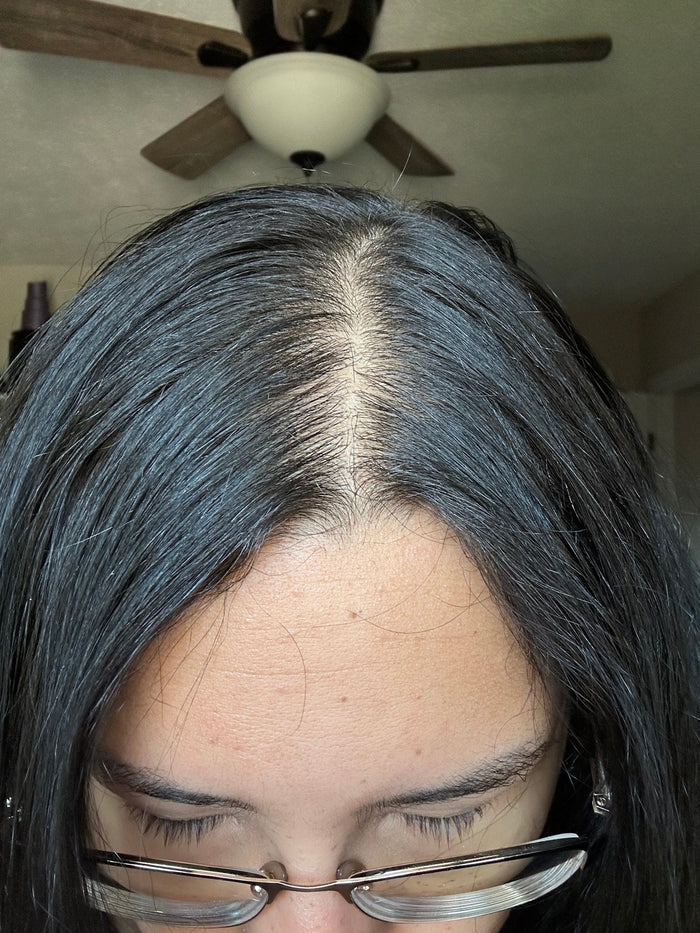 Antes