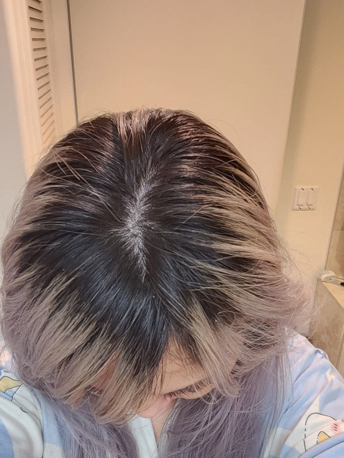 Antes