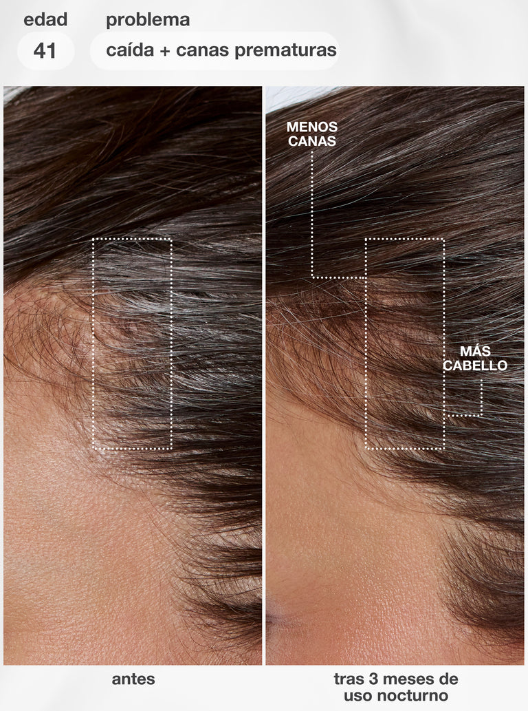 futureiq™-biomimetic-hair-longevity-serum